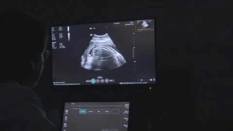 Close-up of sonogram screen displaying baby development during pregnancy checkup Video stock 337789457