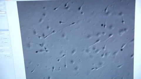 Close-up, sperm under magnification. Stock Footage 76364659