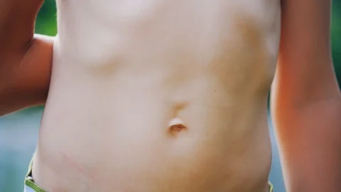 Close-up stomach of a boy. Young boy pulls his belly and shows ribs  Stockbeeldmateriaal 111945913