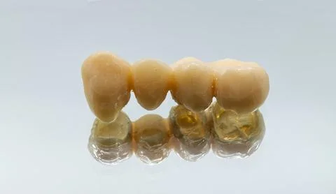 A close-up studio shot of a three-unit dental bridge. Stock Photos