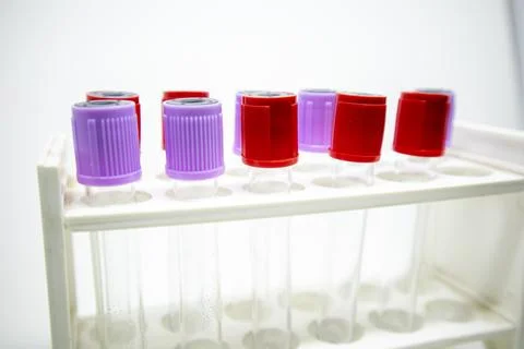A close-up studio shot of a white rack holding multiple medical blood colle.. Stock-Fotos