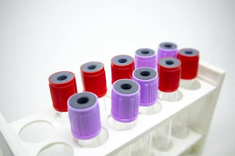 A close-up studio shot of a white rack holding multiple medical blood colle.. Stock Photos