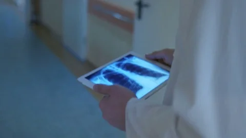 Close-up of studying an x-ray Stock Footage 75131749