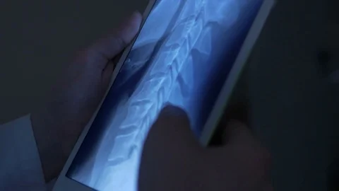 Close-up of studying an x-ray image Stock Footage 75132485