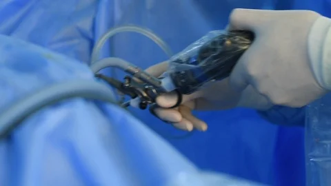Close-up of surgeon hands performing laparoscopic surgery Video stock 108278467