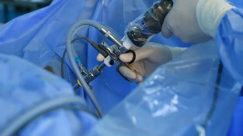 Close-up of surgeon hands performing laparoscopic surgery Video stock 108278558