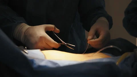 Close up of a surgeon's hand suturing a wound after a successful operation Stock Footage 173515892