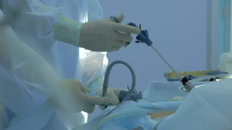 Close-up of surgeon's hands in operating room, real laparoscopic operation Stock Footage 132726009