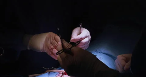 Close up of surgeons hands suturing patient stomach Stock Footage 146652687