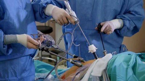 Close-up of surgeons team performing laparoscopic surgery Stock Footage 111719754
