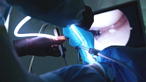 Close-Up of Surgeons Using Advanced Laparoscopic Tools with Illuminated Fibe 動画素材 296929724