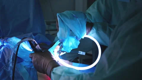Close-Up of Surgeons Using Modern Laparoscopic Instruments with Glowing Ligh 動画素材 296929727