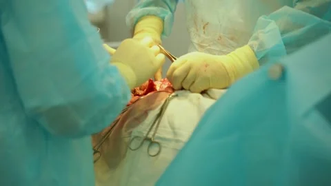 Close-up of surgeons working during an operation on the open abdomen of a Stock Footage 254852872