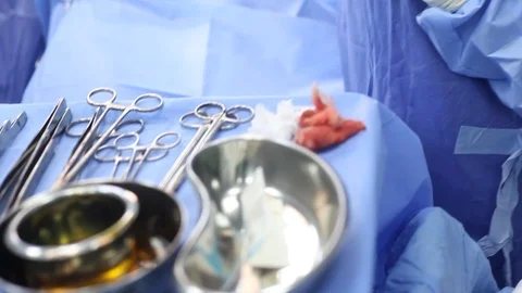 Close up of surgery equipment Vídeos de archivo 92486166