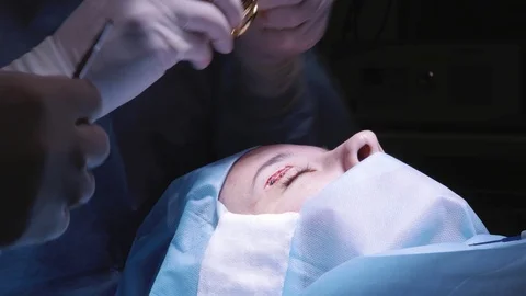 Close-up. surgical intervention. Cut on the eye Stock Footage 124404062
