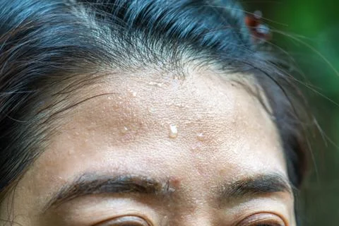 Close up sweat on forehead 스톡 사진