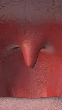Close-up of a swollen uvula inside a human mouth Illustration