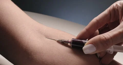 Close-up of taking blood sample from vein. Blood analysis, laboratory Stock Footage 254118014