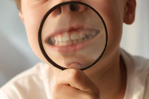 Close-up teeth through magnifying glass. Diastema of front teeth. Erupting Stock Photos