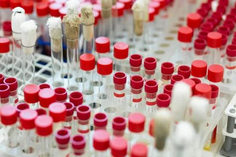 Close up of test tubes that being on support Foto stock