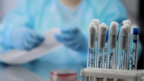 Close-up of test tubes with images of tests in the laboratory. Stock Footage 314343371