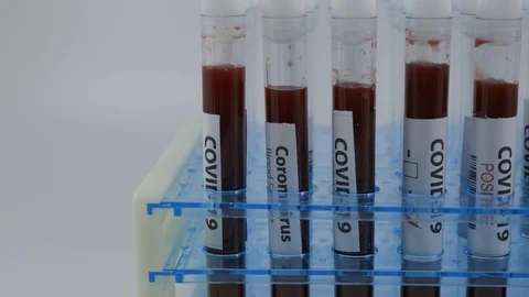 Close up of test tubes rack with blood sample for coronavirus, covid-19 virus Stock Footage 125268552