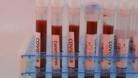 Close up of test tubes rack with blood sample for coronavirus, covid-19 virus Stock Footage 125268638