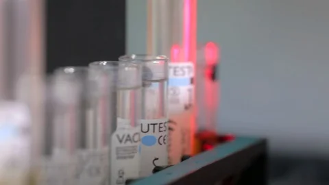Close-up of test tubes in research apparatus in medical laboratory, virus Stock Footage 128642260