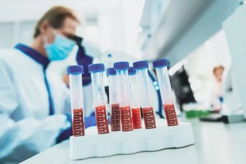 Close up of test tubes that standing on support Stockfoto's