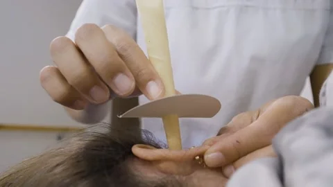 Close-up of a therapist inserting a ear candle into a patient's ear for an Stock Footage 151728887