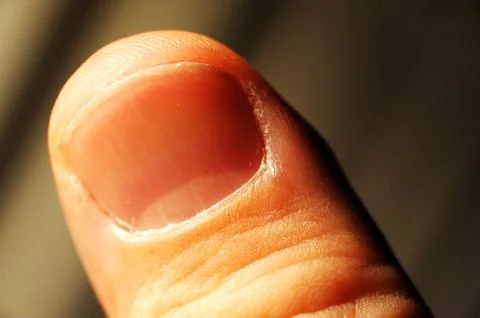 Close up of the thumbs Stock Photos