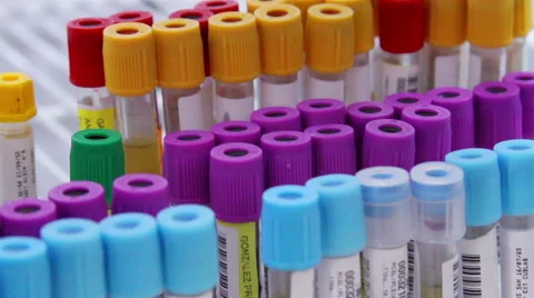 CLOSE UP-TILT DOWN. Blood test tubes in a rack. Stock Footage 45819072