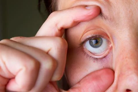 Close up of tired eye Stock Photos