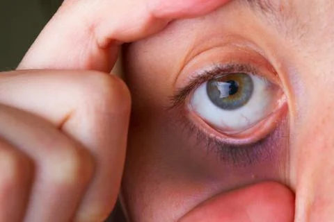 Close up of tired eye Stock Photos