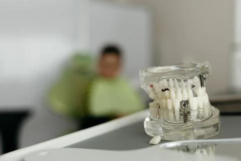 Close up tooth model / mock tooth in dental clinic. Mock tooth or tooth mod.. Stock Photos