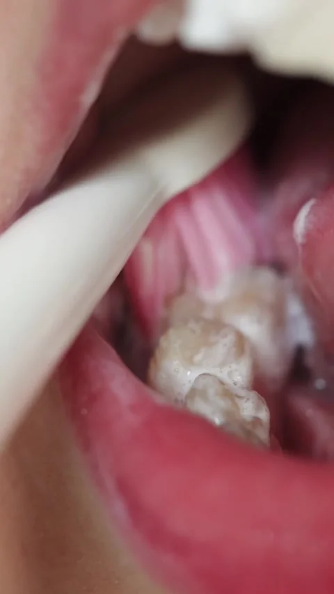 Close-up of toothbrush cleaning teeth and tongue for oral hygiene Vidéo 343838035