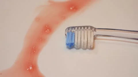 Close up of a toothbrush lying in a bathroom sink with traces of blood. Concept Stock Footage 334943827