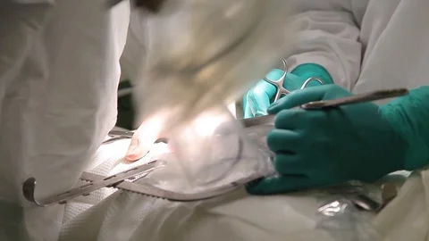 Close-up. Two Doctors in protective clothing perform oncological surgery using Stock Footage 94019776