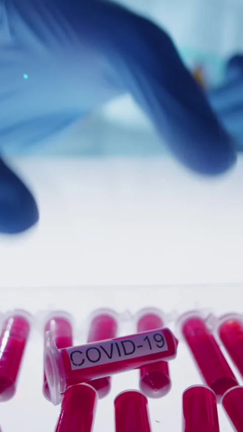 Close-up of Unrecognizable Gloved Hand Researching Blood Sample Test Tube in Lab Stock Footage 315282918