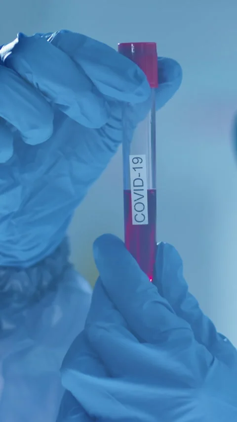 Close-up of Unrecognizable Scientist Examining Test Tube with Blood Sample Stock Footage 315281954