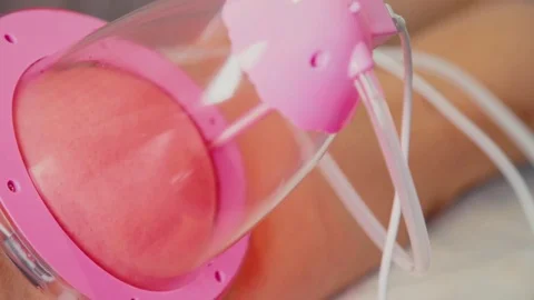 Close-up of vacuum massage the buttocks. Massage of female hips Stock Footage 70387933