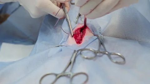 Close-up of a veterinary surgeon's hands in sterile gloves suturing a wound Stock-Footage 341704513