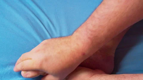 Close-up video of a man massaging his foot 스톡 동영상 335683153