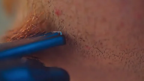 Close-up video of a man shaving a beard and facial hair with a trimmer. Stock Footage 288495363