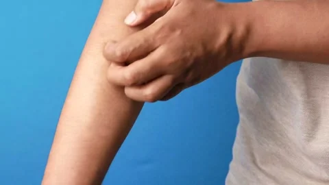 Close up video of person scratching arm due to itching on blue background. Stock Footage 332745482