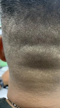 Close up view of the back of a man's head Stock Photos
