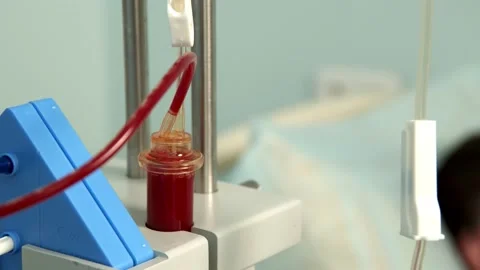 Close-up view of blood flows out of the jar through a tube Видео 158546794