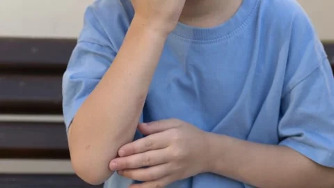 Close view of a boy touching and examining fresh wound on his arm. Child raises Stock-Footage 321817210