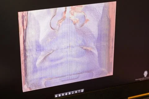 Close-up view of a dental computer diagnostics monitor displaying a special.. Stock Photos