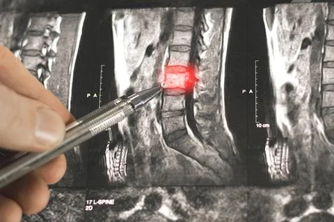 Close up view of diagnosing x-ray human spine. Foto stock